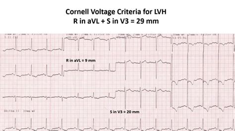 lv high voltage|lvh voltage criteria litfl.